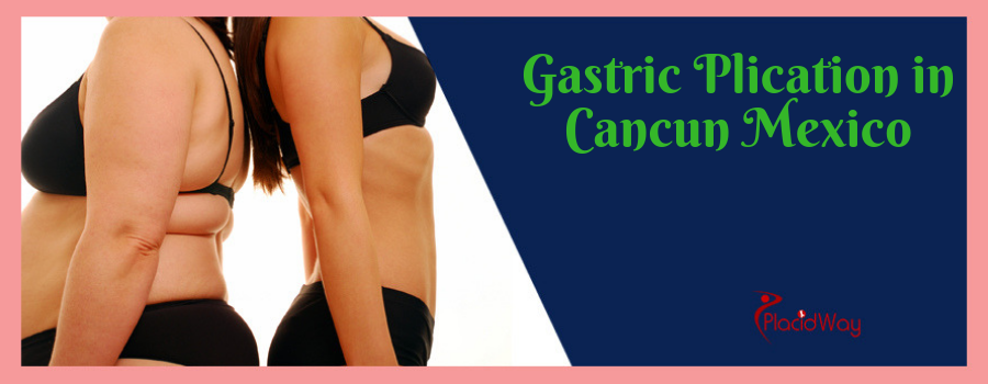 Gastric Plication in Cancun